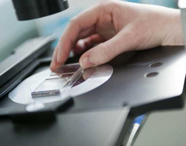 SAMe或成慢性結腸炎新希望？